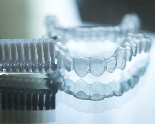 braces-aligners-1