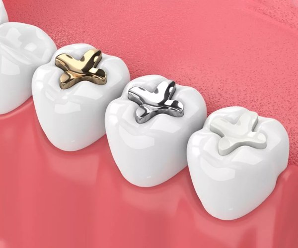 denticaone-img