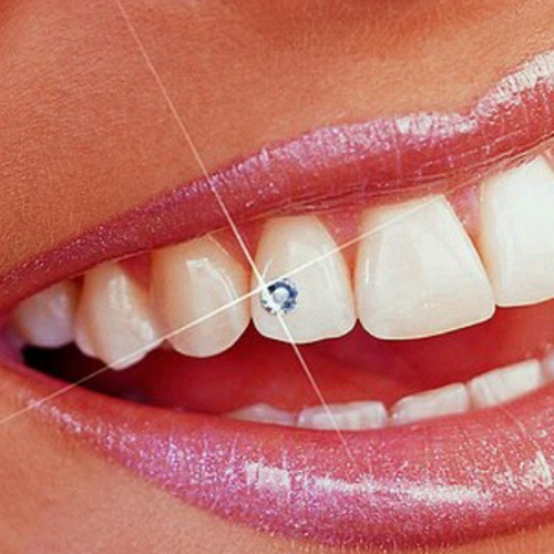 tooth_t1